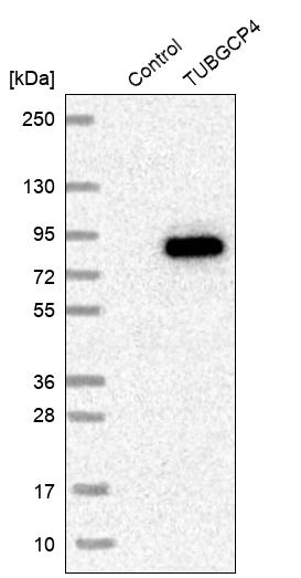 Western blot analysis in control (vector only transfected HEK293T lysate) and TUBGCP4 over-expression lysate (Co-expressed with a C-terminal myc-DDK tag (~3.1 kDa) in mammalian HEK293T cells, LY415269). Western blot analysis in control (vector only transfected HEK293T lysate) and TUBGCP4 over-expression lysate (Co-expressed with a C-terminal myc-DDK tag (~3.1 kDa) in mammalian HEK293T cells, LY415269).