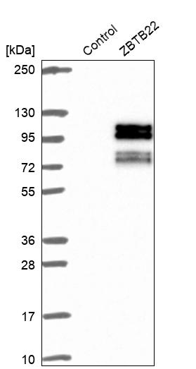 Western blot analysis in control (vector only transfected HEK293T lysate) and ZBTB22 over-expression lysate (Co-expressed with a C-terminal myc-DDK tag (~3.1 kDa) in mammalian HEK293T cells, LY417293).