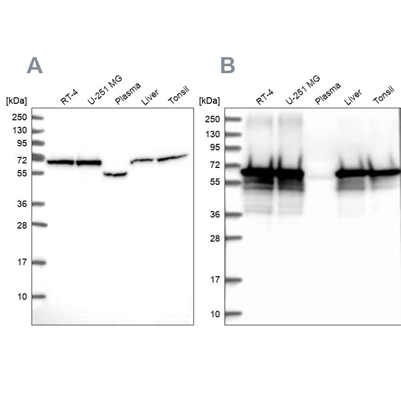 Western blot analysis using Anti-STIP1 antibody HPA044062 (A) shows similar pattern to independent antibody HPA039291 (B).