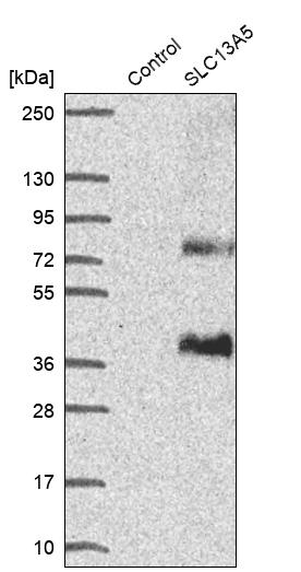 Western blot analysis in control (vector only transfected HEK293T lysate) and SLC13A5 over-expression lysate (Co-expressed with a C-terminal myc-DDK tag (~3.1 kDa) in mammalian HEK293T cells, LY406081).