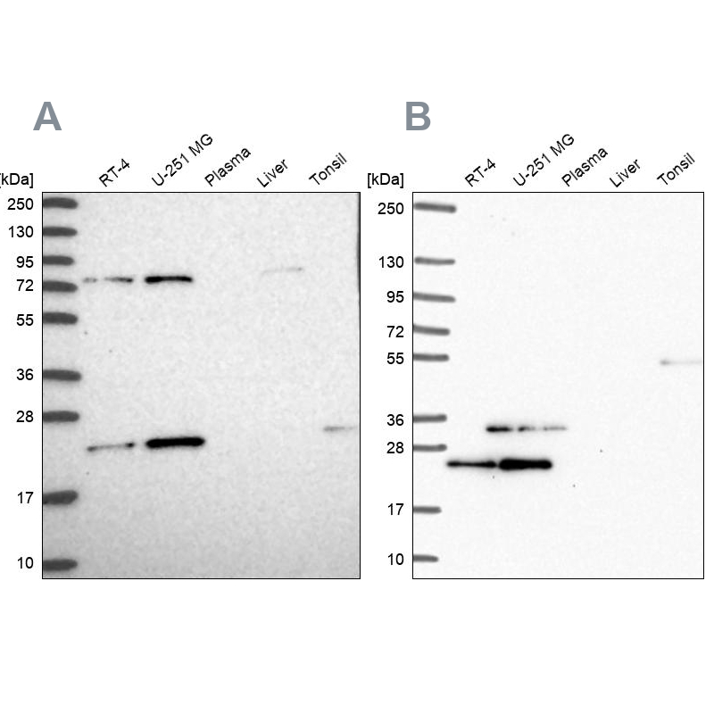 Western blot analysis using Anti-EIF3K antibody HPA045446 (A) shows similar pattern to independent antibody HPA054590 (B). Western blot analysis using Anti-EIF3K antibody HPA045446 (A) shows similar pattern to independent antibody HPA054590 (B).