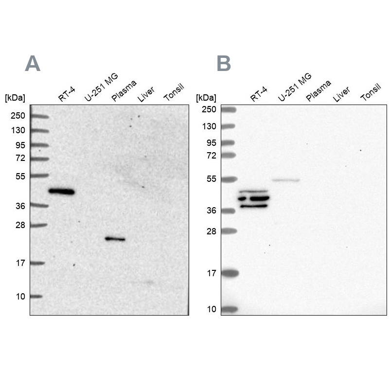 Western blot analysis using Anti-SPESP1 antibody HPA045936 (A) shows similar pattern to independent antibody HPA051040 (B).