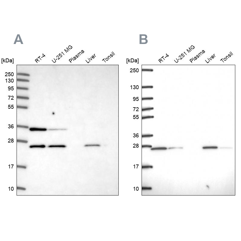 Western blot analysis using Anti-ATP5F1 antibody HPA046067 (A) shows similar pattern to independent antibody HPA057347 (B).