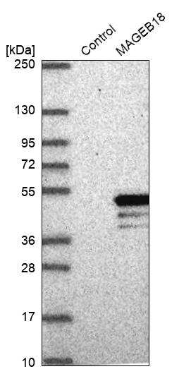 Western blot analysis in control (vector only transfected HEK293T lysate) and MAGEB18 over-expression lysate (Co-expressed with a C-terminal myc-DDK tag (~3.1 kDa) in mammalian HEK293T cells, LY406567). Western blot analysis in control (vector only transfected HEK293T lysate) and MAGEB18 over-expression lysate (Co-expressed with a C-terminal myc-DDK tag (~3.1 kDa) in mammalian HEK293T cells, LY406567).