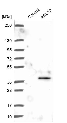 Western blot analysis in control (vector only transfected HEK293T lysate) and ARL10 over-expression lysate (Co-expressed with a C-terminal myc-DDK tag (~3.1 kDa) in mammalian HEK293T cells, LY406546). Western blot analysis in control (vector only transfected HEK293T lysate) and ARL10 over-expression lysate (Co-expressed with a C-terminal myc-DDK tag (~3.1 kDa) in mammalian HEK293T cells, LY406546).