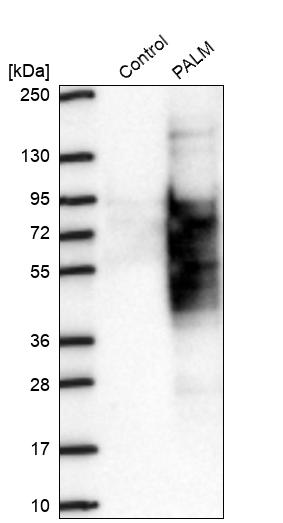 Western blot analysis in control (vector only transfected HEK293T lysate) and PALM over-expression lysate (Co-expressed with a C-terminal myc-DDK tag (~3.1 kDa) in mammalian HEK293T cells, LY419238). Western blot analysis in control (vector only transfected HEK293T lysate) and PALM over-expression lysate (Co-expressed with a C-terminal myc-DDK tag (~3.1 kDa) in mammalian HEK293T cells, LY419238).
