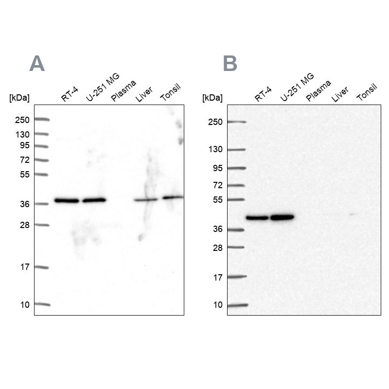 Western blot analysis using Anti-PSMD7 antibody HPA049824 (A) shows similar pattern to independent antibody HPA056069 (B).