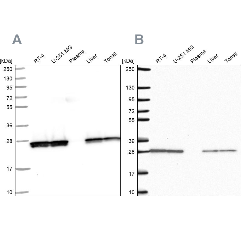 Western blot analysis using Anti-TPI1 antibody HPA050924 (A) shows similar pattern to independent antibody HPA053568 (B).