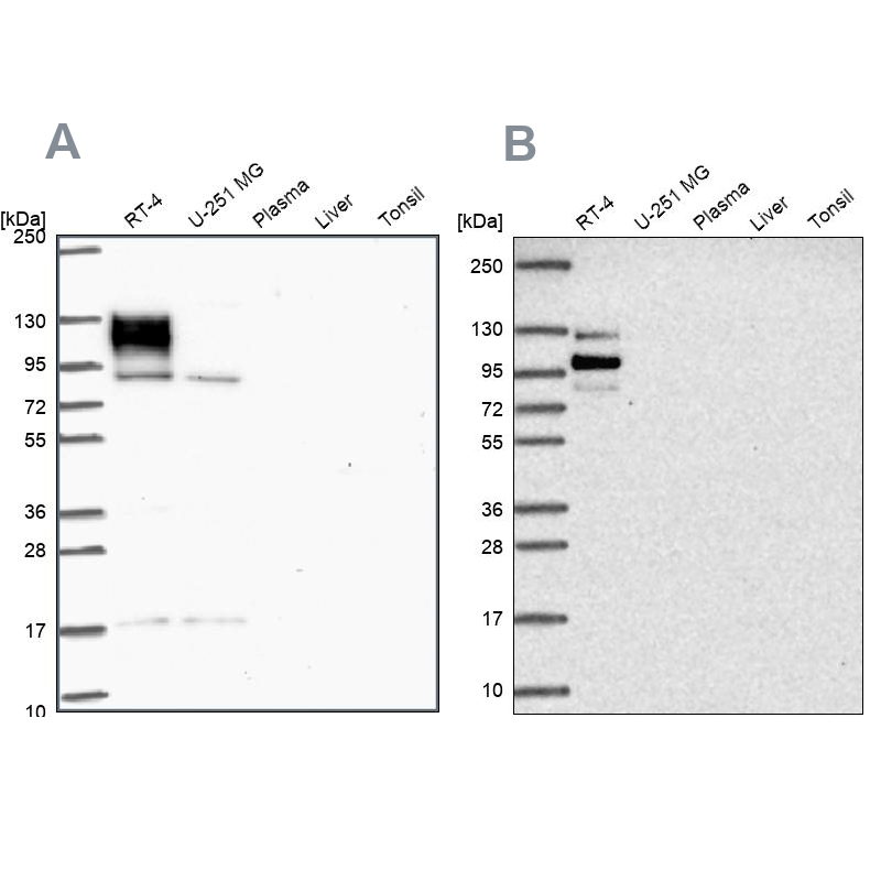 Western blot analysis using Anti-EPB41L1 antibody HPA054104 (A) shows similar pattern to independent antibody HPA056817 (B). Western blot analysis using Anti-EPB41L1 antibody HPA054104 (A) shows similar pattern to independent antibody HPA056817 (B).