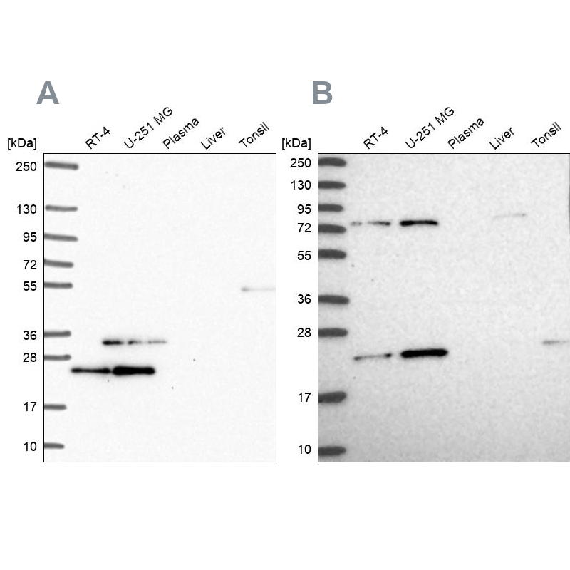 Western blot analysis using Anti-EIF3K antibody HPA054590 (A) shows similar pattern to independent antibody HPA045446 (B). Western blot analysis using Anti-EIF3K antibody HPA054590 (A) shows similar pattern to independent antibody HPA045446 (B).