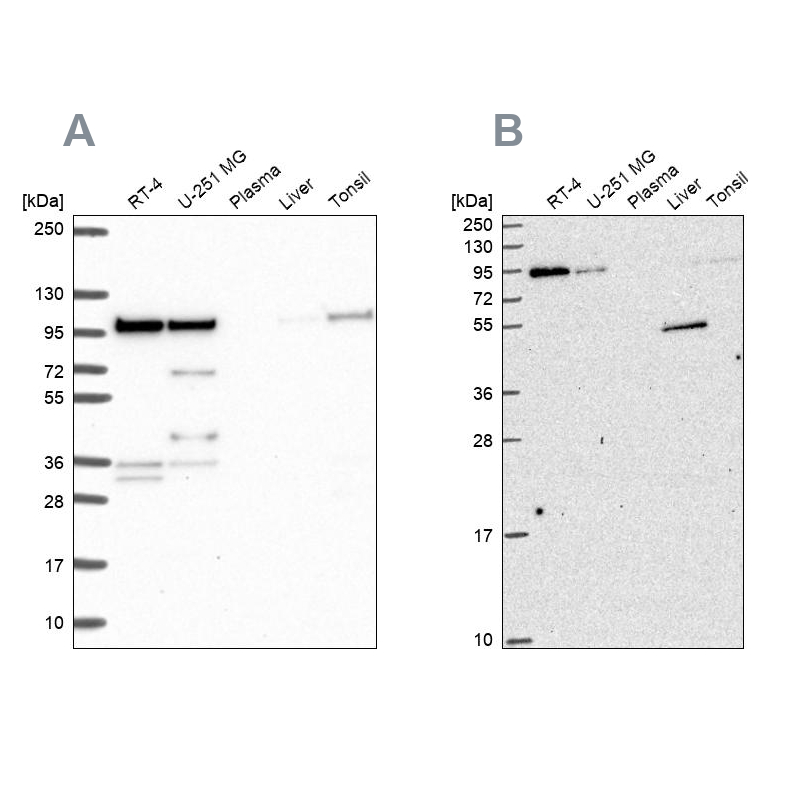 Western blot analysis using Anti-ZW10 antibody HPA055410 (A) shows similar pattern to independent antibody HPA051253 (B). Western blot analysis using Anti-ZW10 antibody HPA055410 (A) shows similar pattern to independent antibody HPA051253 (B).