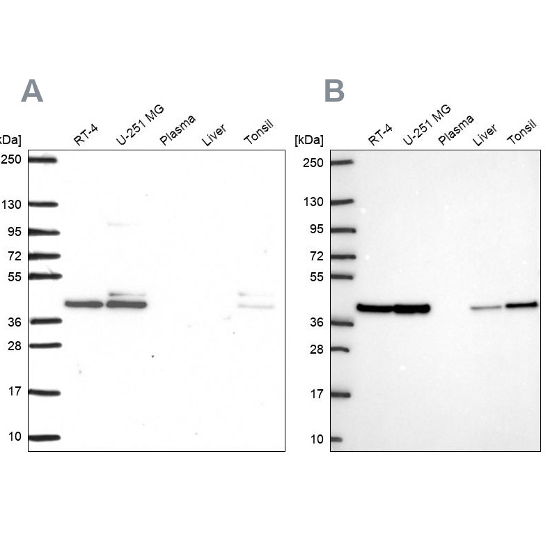 Western blot analysis using Anti-STRAP antibody HPA055557 (A) shows similar pattern to independent antibody HPA073876 (B).