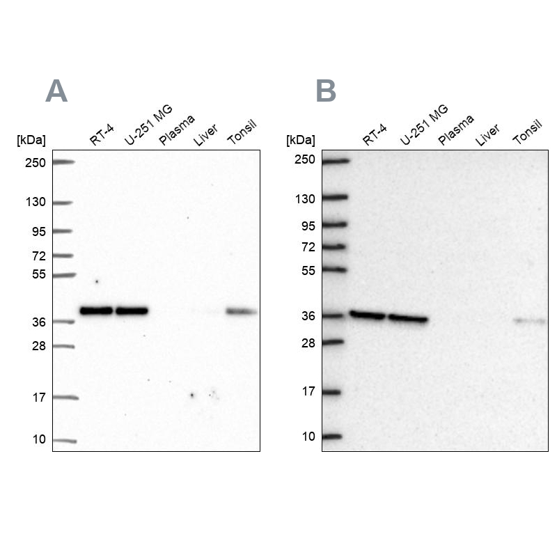Western blot analysis using Anti-NUP37 antibody HPA056300 (A) shows similar pattern to independent antibody HPA073708 (B). Western blot analysis using Anti-NUP37 antibody HPA056300 (A) shows similar pattern to independent antibody HPA073708 (B).