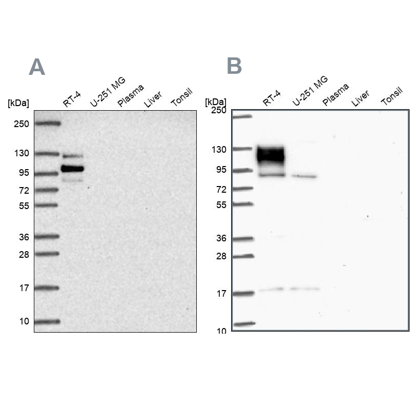 Western blot analysis using Anti-EPB41L1 antibody HPA056817 (A) shows similar pattern to independent antibody HPA054104 (B). Western blot analysis using Anti-EPB41L1 antibody HPA056817 (A) shows similar pattern to independent antibody HPA054104 (B).