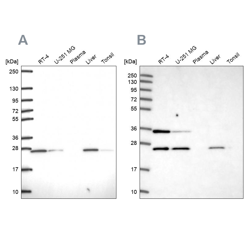 Western blot analysis using Anti-ATP5F1 antibody HPA057347 (A) shows similar pattern to independent antibody HPA046067 (B).