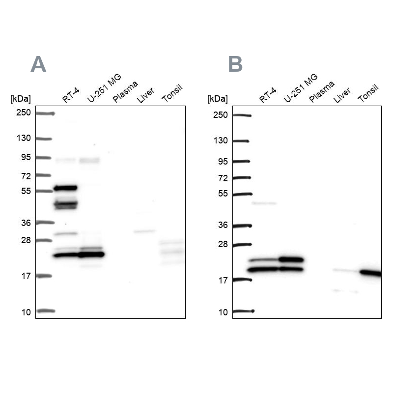 Western blot analysis using Anti-RSL24D1 antibody HPA062724 (A) shows similar pattern to independent antibody HPA063392 (B).