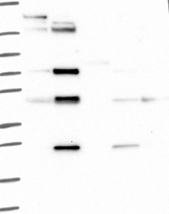 Lane 1: Marker [kDa] 250, 130, 95, 72, 55, 36, 28, 17, 10 | Lane 2: RT4 | Lane 3: U-251 MG | Lane 4: Human Plasma | Lane 5: Liver | Lane 6: Tonsil