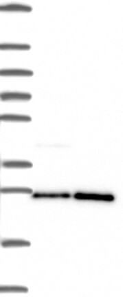 Lane 1: Marker [kDa] 250, 130, 95, 72, 55, 36, 28, 17, 10 | Lane 2: RT4 | Lane 3: U-251 MG