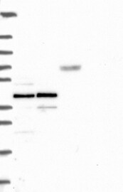 Lane 1: Marker [kDa] 250,130,95,72,55,36,28,17,10 Lane 2: RT-4 Lane 3: U-251MG Lane 4: Human Plasma Lane 5: Liver Lane 6: Tonsil