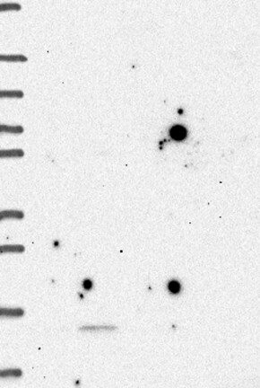 Lane 1: Marker [kDa] 250, 130, 95, 72, 55, 36, 28, 17, 10 | Lane 2: RT4 | Lane 3: U-251 MG | Lane 4: Human Plasma | Lane 5: Liver | Lane 6: Tonsil