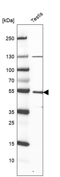 Western blot analysis in human testis tissue. Western blot analysis in human testis tissue.
