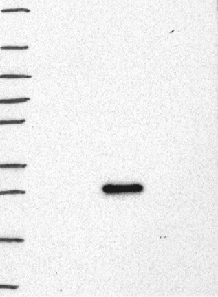 Lane 1: Marker [kDa] 250, 130, 95, 72, 55, 36, 28, 17, 10 | Lane 2: RT4 | Lane 3: U-251 MG | Lane 4: Human Plasma | Lane 5: Liver | Lane 6: Tonsil