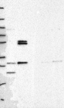 Lane 1: Marker [kDa] 250, 130, 95, 72, 55, 36, 28, 17, 10 | Lane 2: RT4 | Lane 3: U-251 MG | Lane 4: Human Plasma | Lane 5: Liver | Lane 6: Tonsil