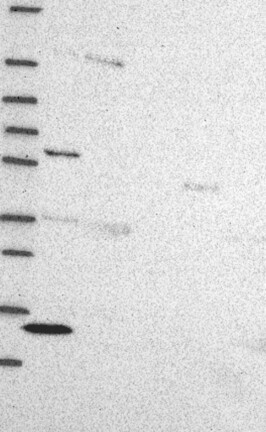 Lane 1: Marker [kDa] 250, 130, 95, 72, 55, 36, 28, 17, 10 | Lane 2: RT4 | Lane 3: U-251 MG | Lane 4: Human Plasma | Lane 5: Liver | Lane 6: Tonsil