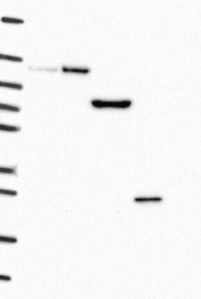Lane 1: Marker [kDa] 250, 130, 95, 72, 55, 36, 28, 17, 10 | Lane 2: RT4 | Lane 3: U-251 MG | Lane 4: Human Plasma | Lane 5: Liver | Lane 6: Tonsil