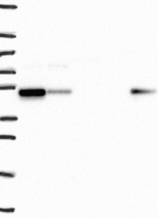 Lane 1: Marker [kDa] 250, 130, 95, 72, 55, 36, 28, 17, 10 | Lane 2: RT4 | Lane 3: U-251 MG | Lane 4: Human Plasma | Lane 5: Liver | Lane 6: Tonsil