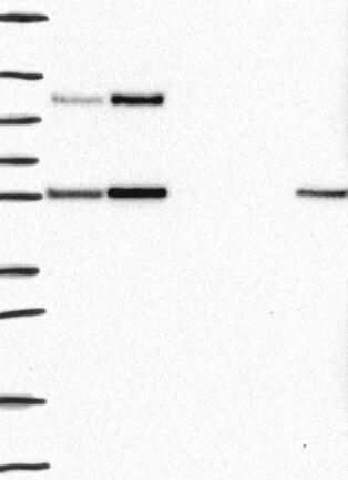 Lane 1: Marker [kDa] 250, 130, 95, 72, 55, 36, 28, 17, 10 | Lane 2: RT4 | Lane 3: U-251 MG | Lane 4: Human Plasma | Lane 5: Liver | Lane 6: Tonsil