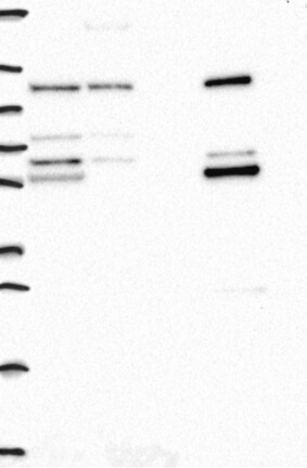 Lane 1: Marker [kDa] 250, 130, 95, 72, 55, 36, 28, 17, 10 | Lane 2: RT4 | Lane 3: U-251 MG | Lane 4: Human Plasma | Lane 5: Liver | Lane 6: Tonsil