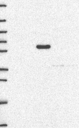Lane 1: Marker [kDa] 250, 130, 95, 72, 55, 36, 28, 17, 10 | Lane 2: RT4 | Lane 3: U-251 MG | Lane 4: Human Plasma | Lane 5: Liver | Lane 6: Tonsil