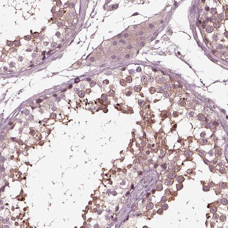 Von Willebrand Factor A Domain Containing 5B1 Antibodies ...