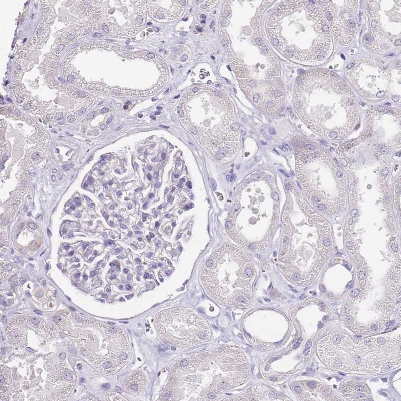 Immunohistochemical staining of human kidney shows low expression as expected.
